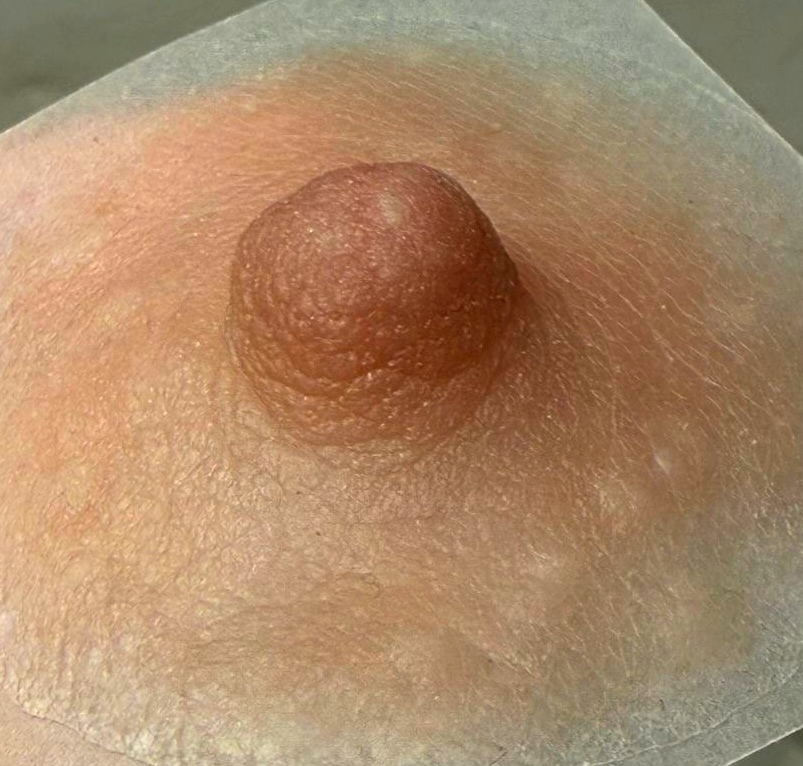 Prótesis de areola clara con textura realista sobre base transparente.