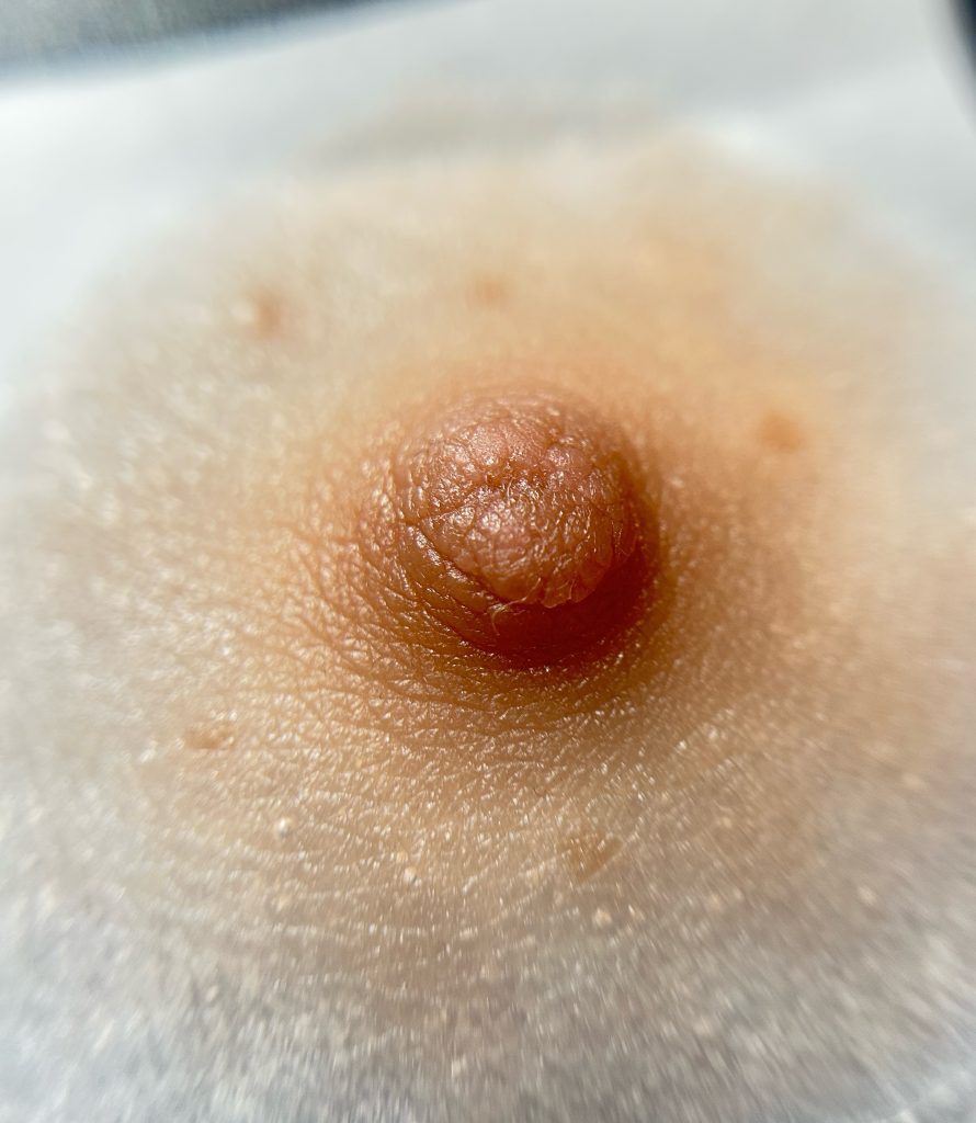 Prótesis de areola personalizada colocada sobre piel clara.